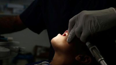 Düzmece dişçi skandalı: Yapıştırıcıyla geçersiz kaplama yaptı, insanlar dişlerini kaybetti