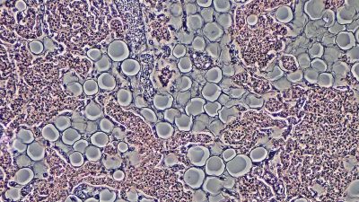 Laboratuvarda birinci canlı insan derisi geliştirildi