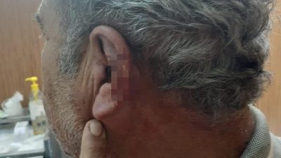 Aile tabibi ile emekli öğretmenin mesai kavgası karakolda bitti