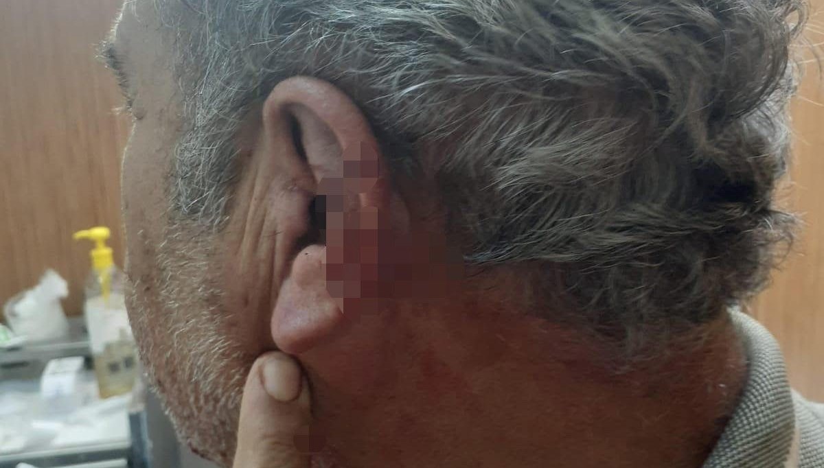 Aile tabibi ile emekli öğretmenin mesai kavgası karakolda bitti