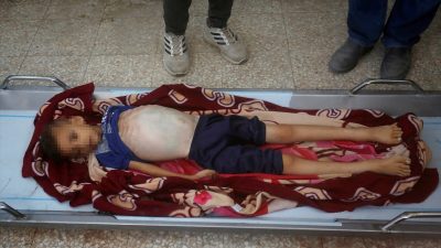 Gazze’de soykırım: 8 yaşındaki çocuk açlıktan hayatını kaybetti