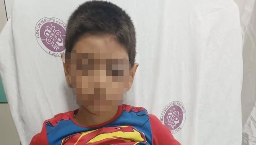 Elazığ'da parkta oğluyla itişen çocuğa