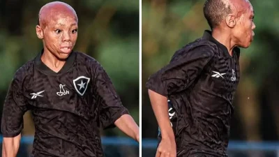 Futbolun Güçlü Sembolü: Bernado Lopes’in İlham Veren Hikayesi