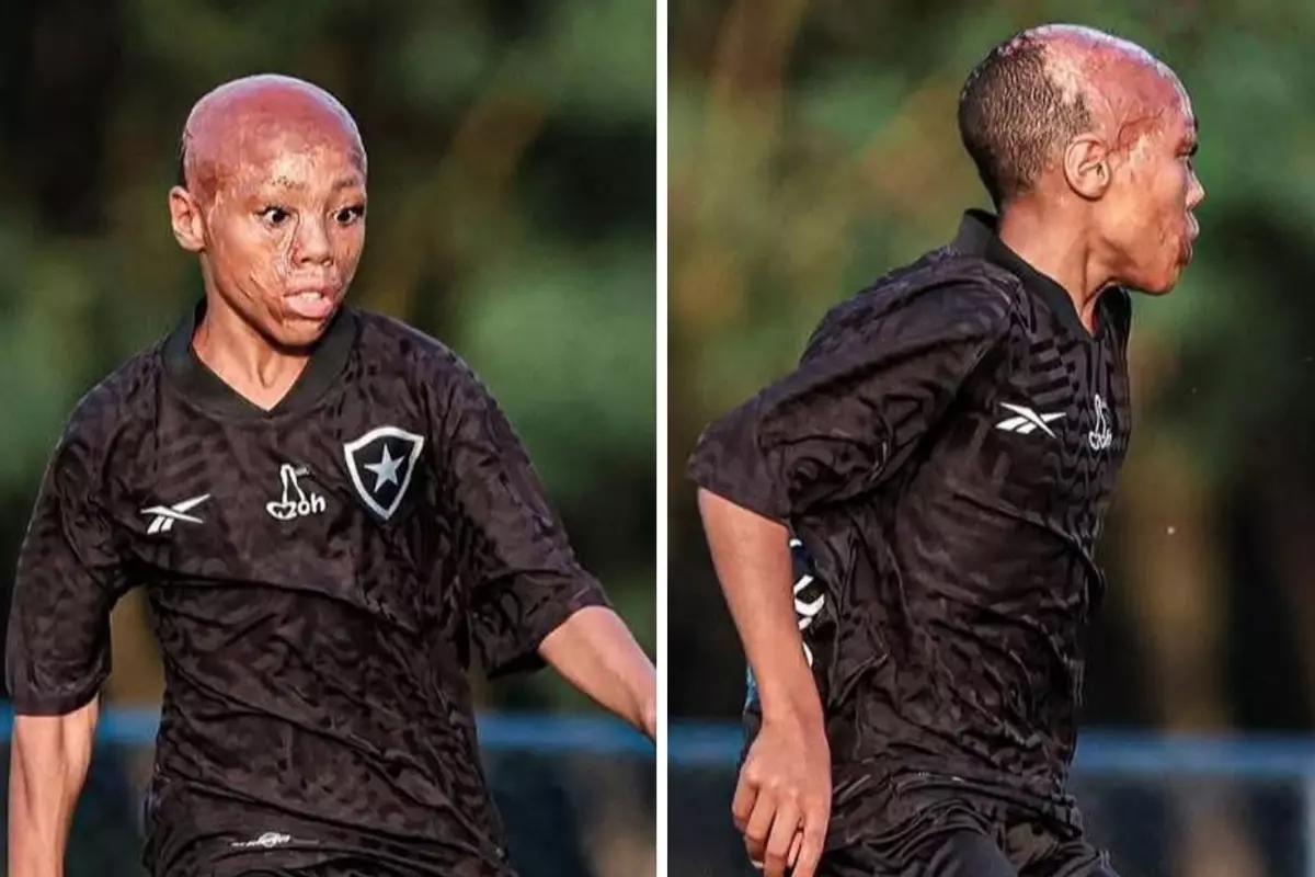 Futbolun Güçlü Sembolü: Bernado Lopes’in İlham Veren Hikayesi