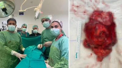 Medistinal Anterior Liposarkom Tedavisinde Başarılı Cerrahi İletişim