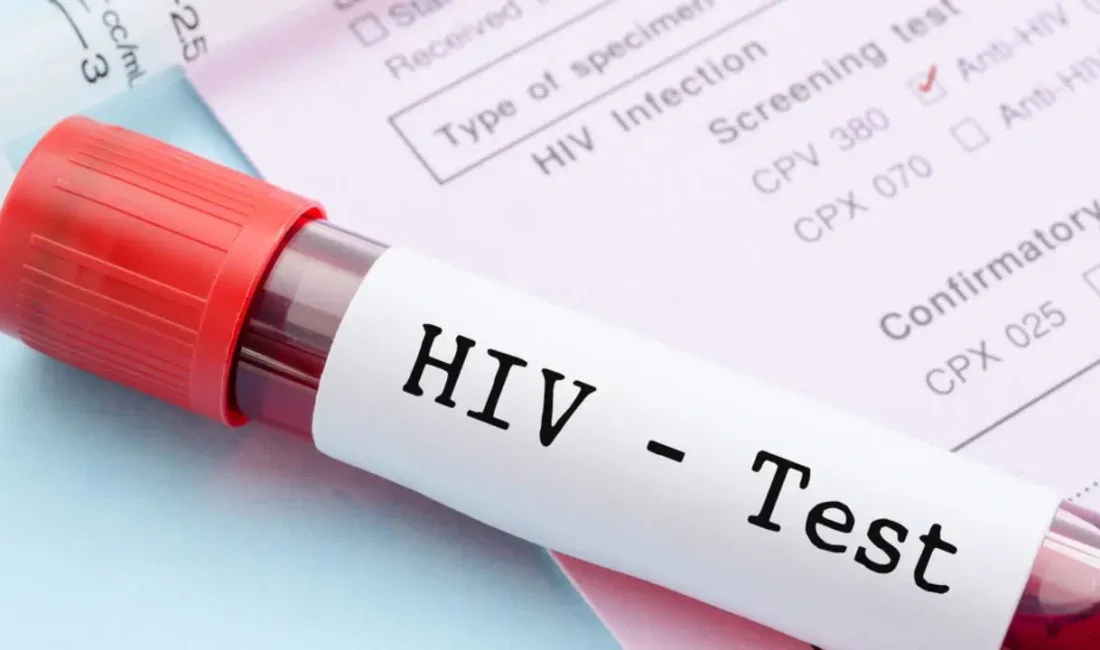 Dünya AIDS Günü’nde HIV