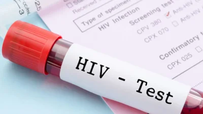 Dünya AIDS Günü’nde HIV Bilincini Artırmaya Yönelik Etkinlikler ve Güncel Yaklaşımlar