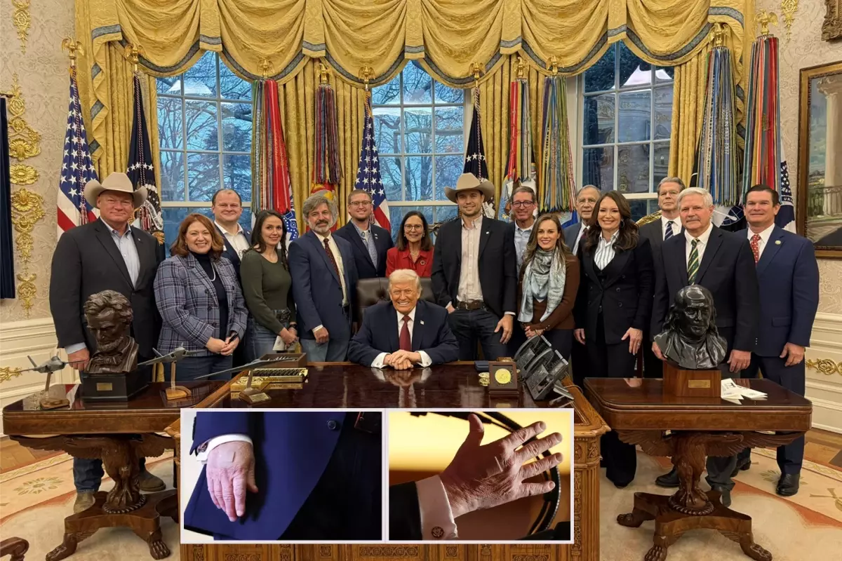 ABD Başkanı Trump’ın El Bandajları ve Sık El Sıkışma Sebepleri