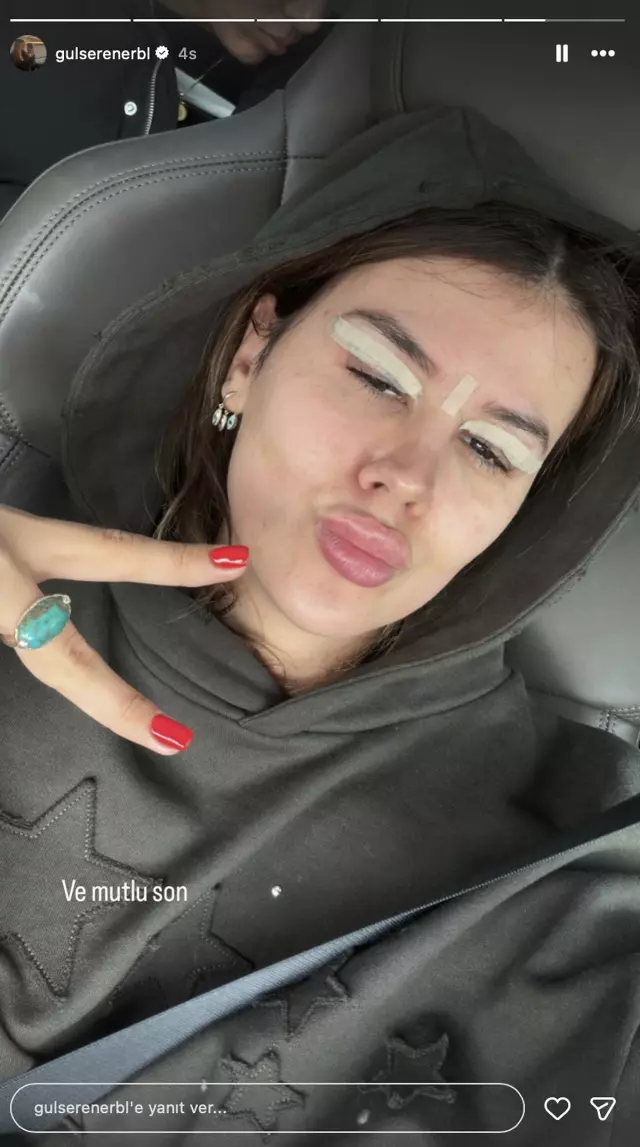 Gülseren Ceylan'ın Estetik Değişimi ve Magazin Gündemi