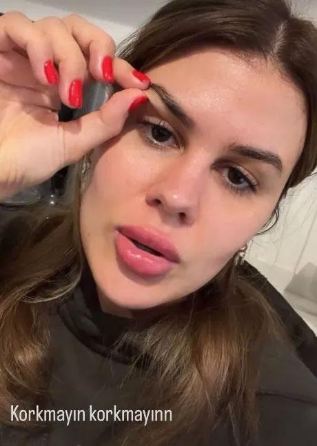 Gülseren Ceylan'ın Estetik Değişimi ve Magazin Gündemi