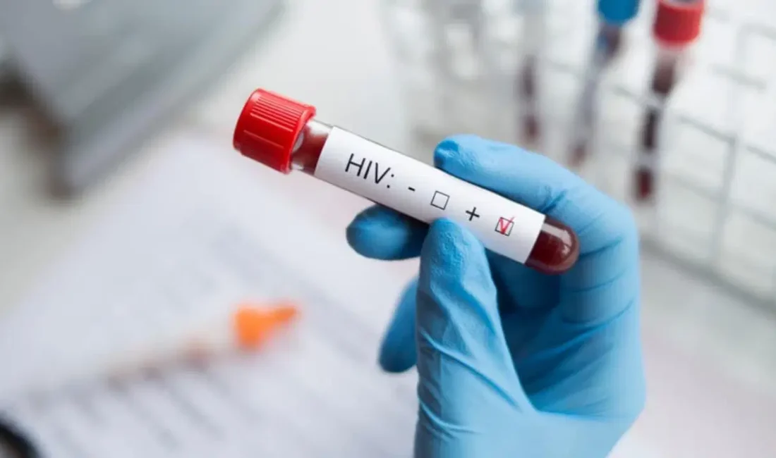 HIV hakkında güncel ve