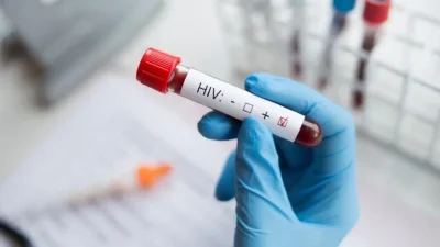 HIV Hakkında Güncel ve Detaylı Bilgilendirme