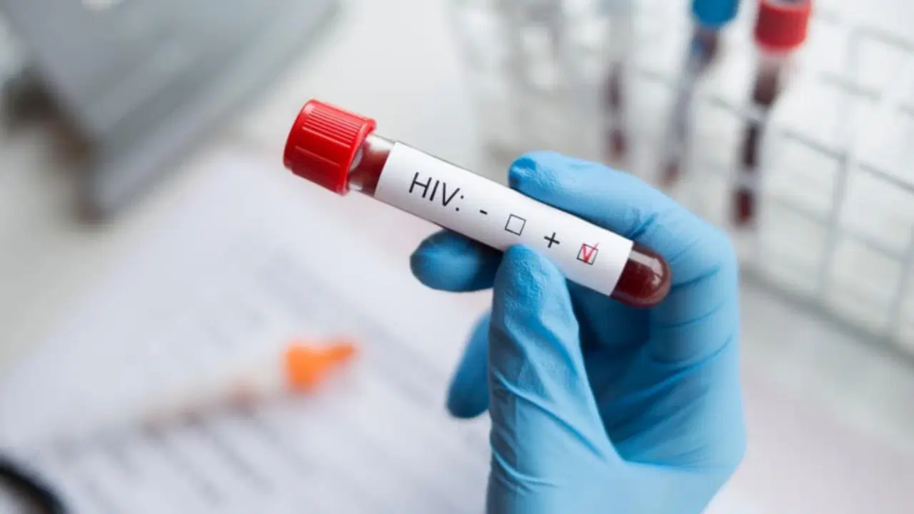 HIV Hakkında Güncel ve Detaylı Bilgilendirme
