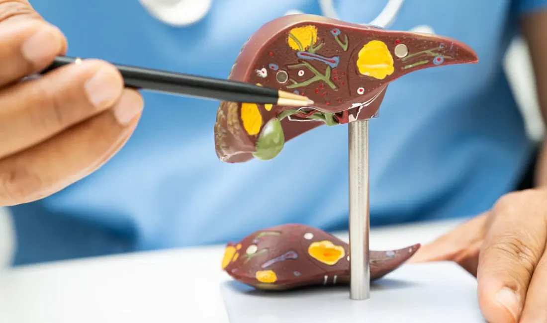 Karaciğer yağlanmasını erken teşhis