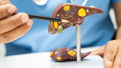 Karaciğer Yağlanmasının Erken Teşhisi ve Yaşam Tarzı Değişiklikleriyle Mücadele