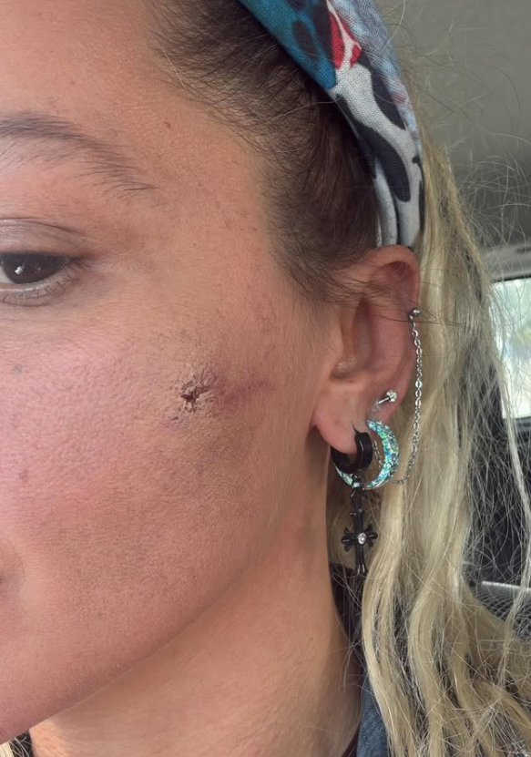 Şiddet Olaylarını Sosyal Medya Üzerinden Duyurdu