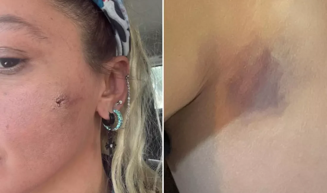 Yıldız Asyalı, eşinden gördüğü