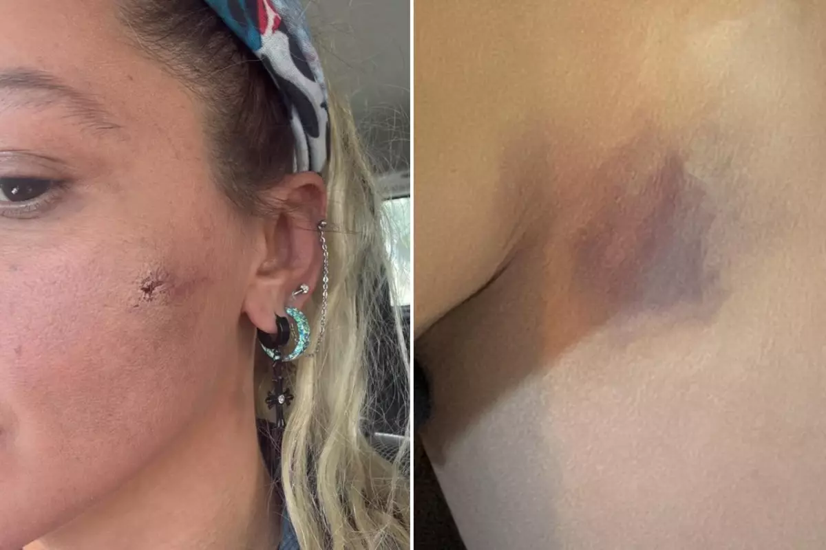 Yıldız Asyalı, Eşinden Görülen Şiddeti Sosyal Medyada Gün Yüzüne Çıkardı